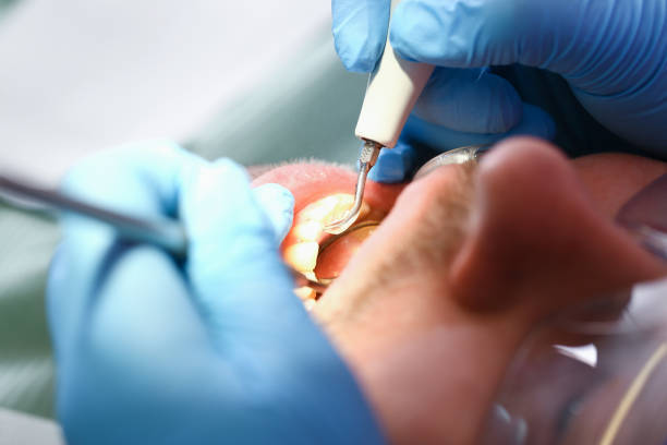 Best Pediatric Emergency Dentist in Englewood, FL